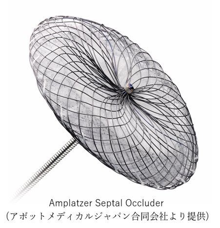 心房中隔欠損症(ASD)のカテーテル治療とは
