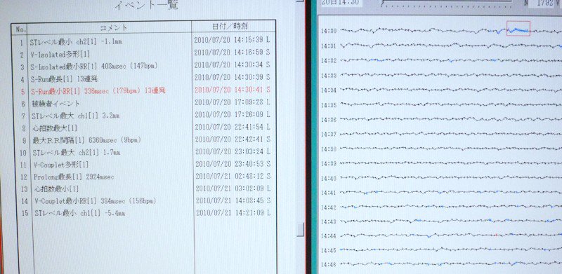 ホルター心電図
