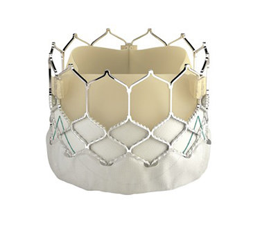 バルーン拡張型